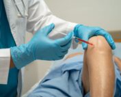 Stem Cell Therapy for Knees