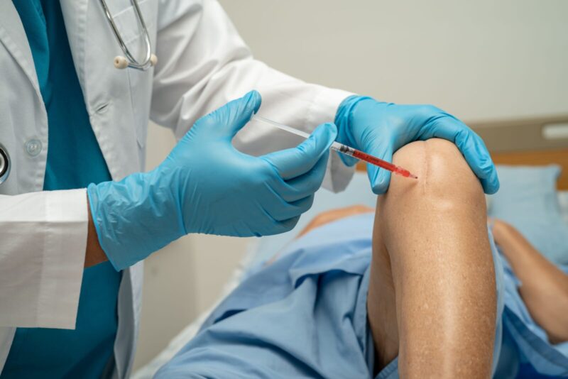 Stem Cell Therapy for Knees