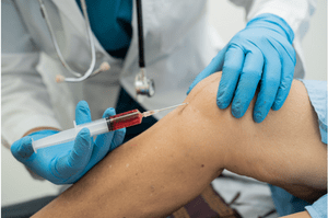 PRP Injection treatment