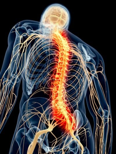 Nerve and Spinal Cord Problems