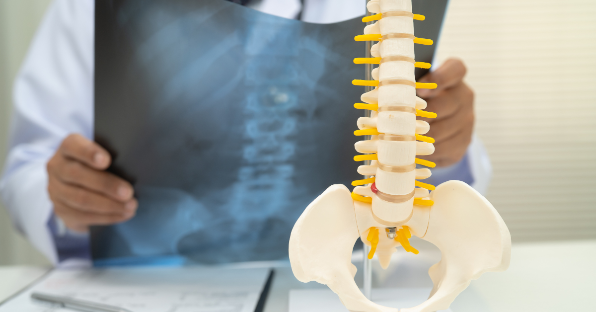 Pain management doctor reviewing spine X-ray with lumbar spine model in Westminster, CA