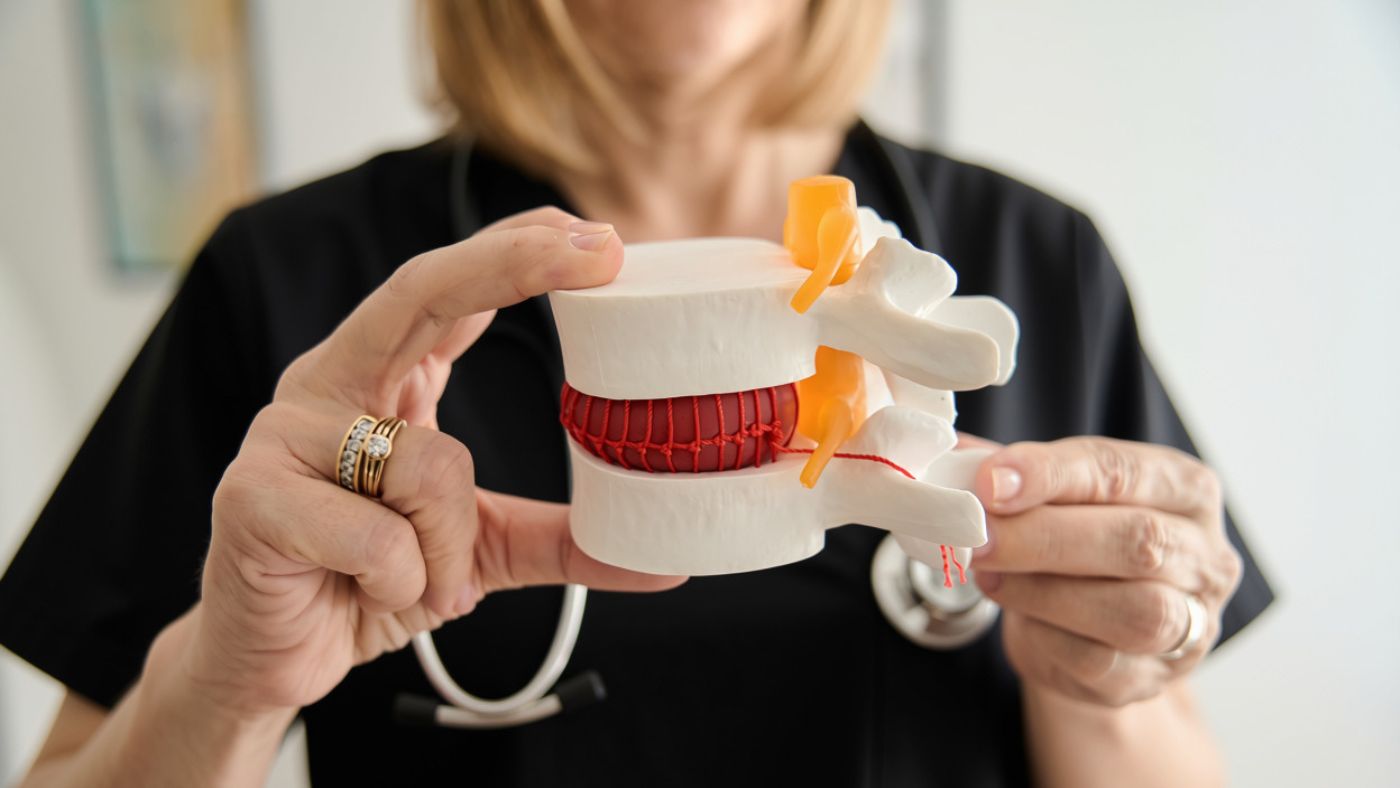 Doctor holding a model of a herniated disc during a patient consultation at OC Wellness Physicians in Orange County