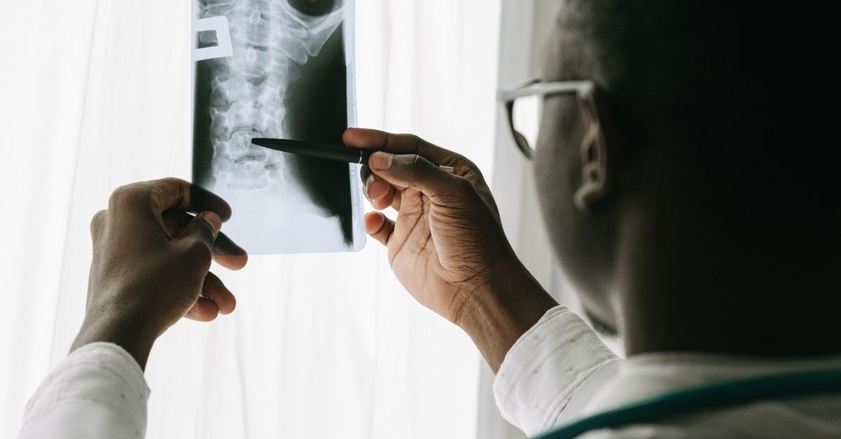 Close-up of a doctor examining a spine X-ray film with a pen in a hospital setting.